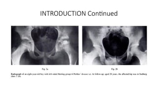 INTRODUCTION Continued
 