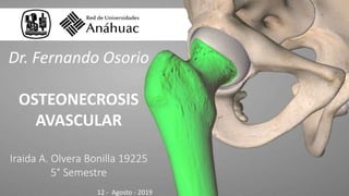 Dr. Fernando Osorio
OSTEONECROSIS
AVASCULAR
Iraida A. Olvera Bonilla 19225
5° Semestre
12 - Agosto - 2019
 