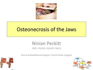 Osteonecrosis of the Jaws
Ninian Peckitt
FRCS FFD RCS FDS RCS FACCS
Oral and Maxillofacial Surgeon / Facial Plastic Surgeon
 