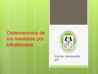 Osteonecrosis de 
los maxilares por 
bifosfonatos 
Carlos Hernando 
gil 
 