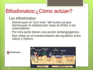 Osteonecrosis y bisfosfonatos | PPT