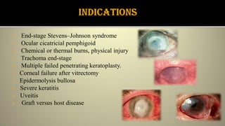  End-stage Stevens–Johnson syndrome
 Ocular cicatricial pemphigoid
 Chemical or thermal burns, physical injury
 Trachoma end-stage
 Multiple failed penetrating keratoplasty.
 Corneal failure after vitrectomy
 Epidermolysis bullosa
 Severe keratitis
 Uveitis
 Graft versus host disease
 