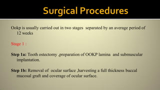 Ookp is usually carried out in two stages separated by an average period of
12 weeks
Stage 1 :
Step 1a: Tooth ostectomy ,preparation of OOKP lamina and submuscular
implantation.
Step 1b: Removal of ocular surface ,harvesting a full thickness buccal
mucosal graft and coverage of ocular surface.
 