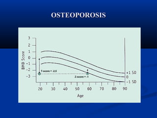 OOSSTTEEOOPPOORROOSSIISS 
 