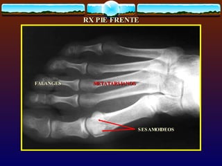 OsteopatíA | PPT
