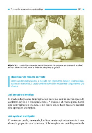 Identificar de manera correcta
Dolores abdominales fuertes, a menudo con retortijones. Palidez, intranquilidad,
estados de cansancio, a veces también diarrea con mucosidad sanguinolenta y/o
vómitos.
Así procede el médico:
El médico diagnostica la invaginación intestinal con un enema opaco de
contraste, rayos X o con ultrasonidos. A menudo, el enema puede hacer
que la invaginación se anule. Si no ocurre así, se hace necesario realizar
una operación quirúrgica.
Así ayuda el osteópata:
El osteópata puede, a menudo, localizar una invaginación intestinal me-
diante la palpación con las manos. Si la invaginación está diagnosticada
Prevención y tratamiento osteopático 105
Figura 27: La osteópata disuelve, cuidadosamente, la invaginación intestinal, aquí en
la zona del transcurso entre el intestino delgado y el grueso.
01 Osteopatía pp. 001-169 26/5/03 11:12 Página 105
 