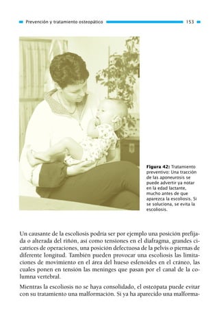 Un causante de la escoliosis podría ser por ejemplo una posición prefija-
da o alterada del riñón, así como tensiones en el diafragma, grandes ci-
catrices de operaciones, una posición defectuosa de la pelvis o piernas de
diferente longitud. También pueden provocar una escoliosis las limita-
ciones de movimiento en el área del hueso esfenoides en el cráneo, las
cuales ponen en tensión las meninges que pasan por el canal de la co-
lumna vertebral.
Mientras la escoliosis no se haya consolidado, el osteópata puede evitar
con su tratamiento una malformación. Si ya ha aparecido una malforma-
Prevención y tratamiento osteopático 153
Figura 42: Tratamiento
preventivo: Una tracción
de las aponeurosis se
puede advertir ya notar
en la edad lactante,
mucho antes de que
aparezca la escoliosis. Si
se soluciona, se evita la
escoliosis.
01 Osteopatía pp. 001-169 26/5/03 11:12 Página 153
 