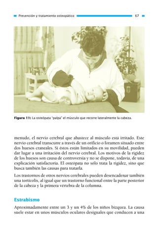 menudo, el nervio cerebral que abastece al músculo está irritado. Este
nervio cerebral transcurre a través de un orificio o foramen situado entre
dos huesos craneales. Si éstos están limitados en su movilidad, pueden
dar lugar a una irritación del nervio cerebral. Los motivos de la rigidez
de los huesos son causa de controversia y no se dispone, todavía, de una
explicación satisfactoria. El osteópata no sólo trata la rigidez, sino que
busca también las causas para tratarla.
Los trastornos de otros nervios cerebrales pueden desencadenar también
una tortícolis, al igual que un trastorno funcional entre la parte posterior
de la cabeza y la primera vértebra de la columna.
Estrabismo
Aproximadamente entre un 3 y un 4% de los niños bizquea. La causa
suele estar en unos músculos oculares desiguales que conducen a una
Prevención y tratamiento osteopático 67
Figura 11: La osteópata “palpa” el músculo que recorre lateralmente la cabeza.
01 Osteopatía pp. 001-169 26/5/03 11:12 Página 67
 