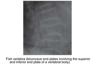 Diagnostic Imaging of Osteopenia | PPT