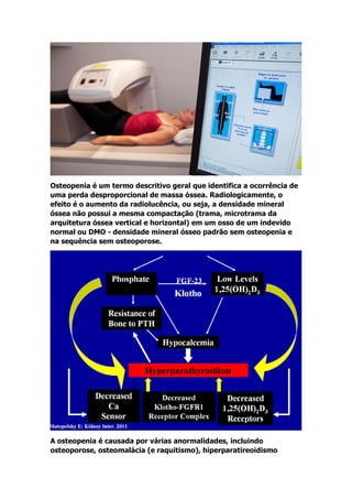 Osteopenia é um termo descritivo geral que identifica a ocorrência de
uma perda desproporcional de massa óssea. Radiologicamente, o
efeito é o aumento da radiolucência, ou seja, a densidade mineral
óssea não possui a mesma compactação (trama, microtrama da
arquitetura óssea vertical e horizontal) em um osso de um indevido
normal ou DMO - densidade mineral ósseo padrão sem osteopenia e
na sequência sem osteoporose.
A osteopenia é causada por várias anormalidades, incluindo
osteoporose, osteomalácia (e raquitismo), hiperparatireoidismo
 