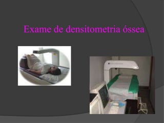 Exame de densitometria óssea 