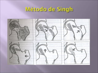 VI    V        IV




III       II   I
 