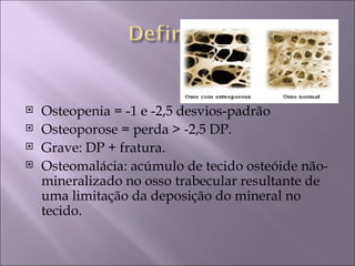    Osteopenia = -1 e -2,5 desvios-padrão
   Osteoporose = perda > -2,5 DP.
   Grave: DP + fratura.
   Osteomalácia: acúmulo de tecido osteóide não-
    mineralizado no osso trabecular resultante de
    uma limitação da deposição do mineral no
    tecido.
 