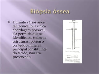    Durante vários anos,
    tal técnica foi a única
    abordagem possível,
    ela permitia que se
    identificasse todas as
    estruturas, porém o
    conteúdo mineral,
    principal constituinte
    do tecido, não era
    preservado.
 