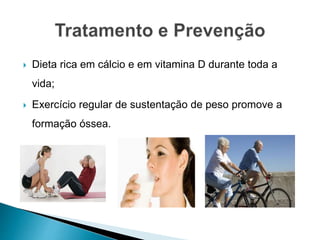 Dieta rica em cálcio e em vitamina D durante toda a
vida;
 Exercício regular de sustentação de peso promove a
formação óssea.
 