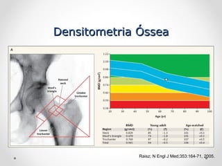 Densitometria Óssea
Densitometria Óssea
Raisz; N Engl J Med;353:164-71, 2005.
 