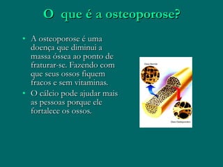 O que é a osteoporose? A osteoporose é uma doença que diminui a massa óssea ao ponto de fraturar-se. Fazendo com que seus ossos fiquem fracos e sem vitaminas. O cálcio pode ajudar mais as pessoas porque ele fortalece os ossos.