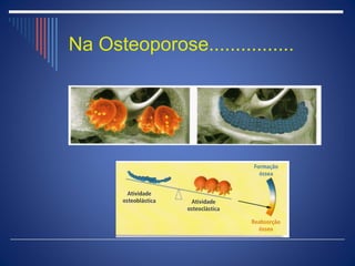 Na Osteoporose................
 