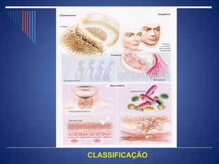 CLASSIFICAÇÃO
 