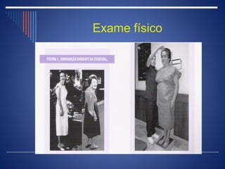 Exame físico
 