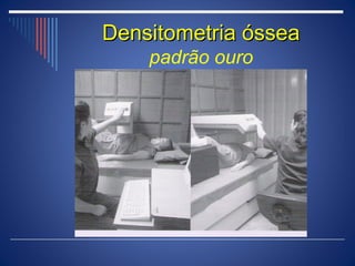 Densitometria óssea
    padrão ouro
 