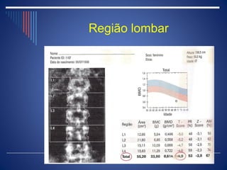 Região lombar
 
