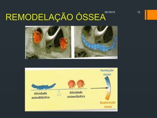 REMODELAÇÃO ÓSSEA
05/19/15 13
 