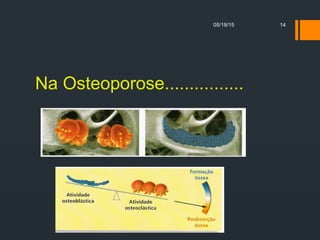 Na Osteoporose................
05/19/15 14
 