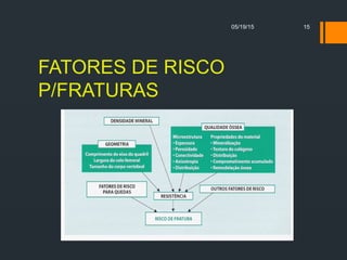 FATORES DE RISCO
P/FRATURAS
05/19/15 15
 