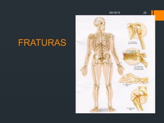 FRATURAS
05/19/15 25
 