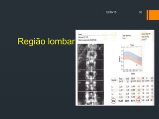 Região lombar
05/19/15 30
 