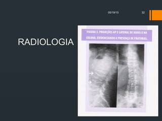 RADIOLOGIA
05/19/15 32
 