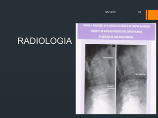 RADIOLOGIA
05/19/15 33
 
