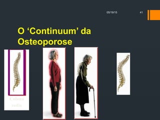 O ‘Continuum’ da
Osteoporose
05/19/15 41
 