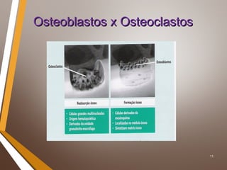 11
Osteoblastos x OsteoclastosOsteoblastos x Osteoclastos
 