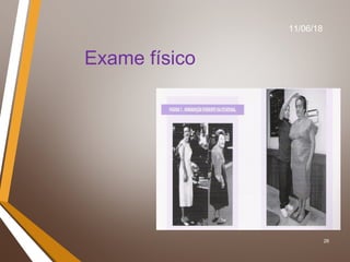 26
Exame físico
11/06/18
 