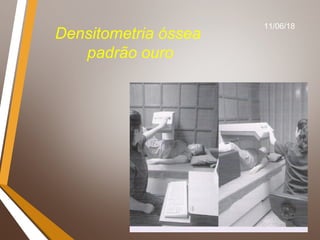 28
Densitometria óssea
padrão ouro
11/06/18
 