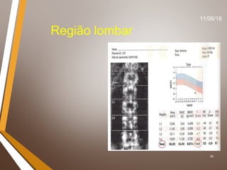30
Região lombar
11/06/18
 