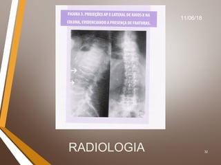 32RADIOLOGIA
11/06/18
 