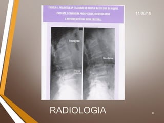 33RADIOLOGIA
11/06/18
 