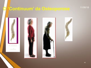 43
O ‘Continuum’ da Osteoporose 11/06/18
 