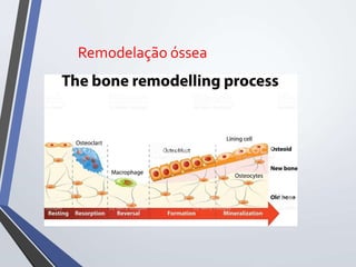 Remodelação óssea
 