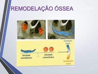 18
REMODELAÇÃO ÓSSEA 16/10/2018
 