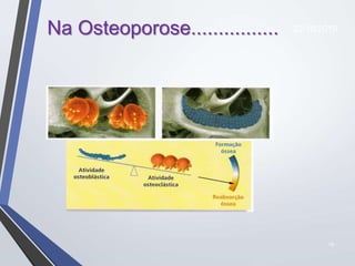 19
Na Osteoporose................ 22/10/2019
 