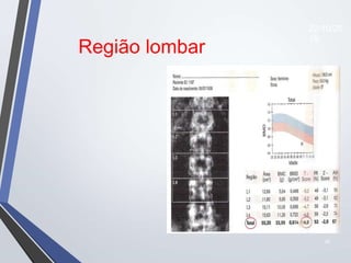 35
Região lombar
22/10/20
19
 
