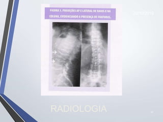 37
RADIOLOGIA
22/10/2019
 