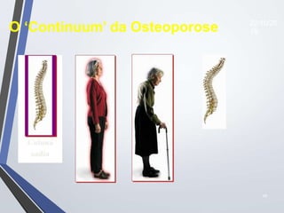 48
O ‘Continuum’ da Osteoporose 22/10/20
19
 
