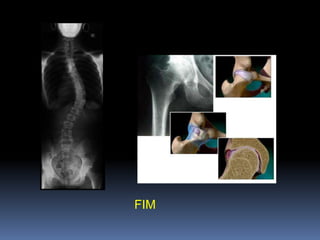 Estrógenos, calcitonina e bifosfonados