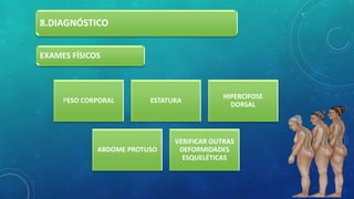 8.DIAGNÓSTICO
PESO CORPORAL ESTATURA
HIPERCIFOSE
DORSAL
ABDOME PROTUSO
VERIFICAR OUTRAS
DEFORMIDADES
ESQUELÉTICAS
EXAMES FÍSICOS
 