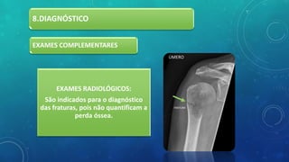 8.DIAGNÓSTICO
EXAMES RADIOLÓGICOS:
São indicados para o diagnóstico
das fraturas, pois não quantificam a
perda óssea.
EXAMES COMPLEMENTARES
ÚMERO
FRATURA
 